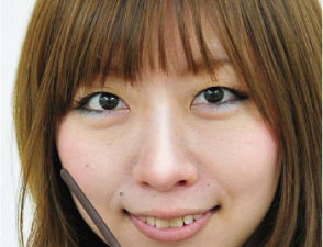 鼻を高く加工後