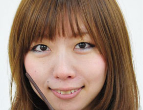 歯を白くする修正前
